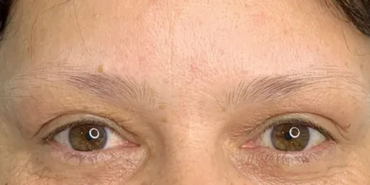 The appearance of a woman's eyebrows before the Combo Brows technique.