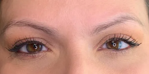 The appearance of a woman's eyebrows before the Combo Brows technique.