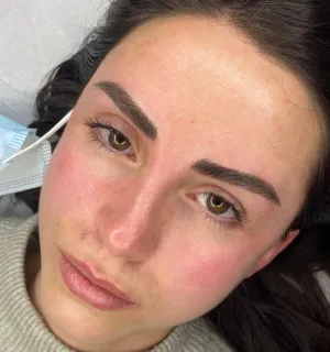 A client's face after a combo brows session.