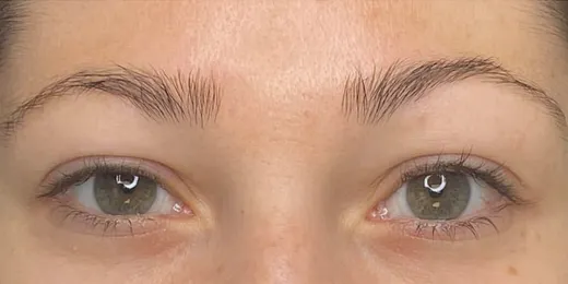 The appearance of a woman's eyebrows before the Microblading technique.