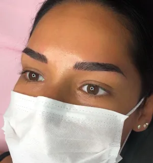 A client's face after a microblading session.