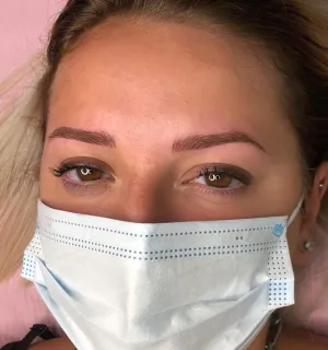 A client's face after a microblading session.