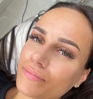 A client's face after a microblading session.