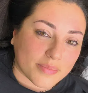 A client's face after a microblading session.